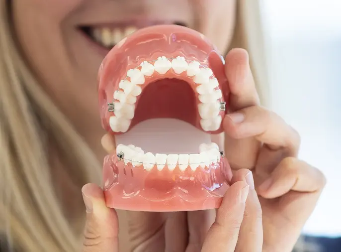 Kjeveortopedi behandling hos Norfloss i Halden